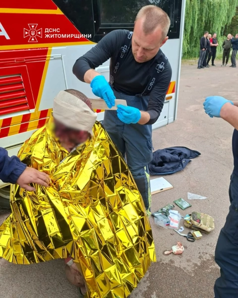 Житомирщина: 6 постраждалих від атаки РФ 17 Житомирщина: 6 постраждалих від атаки РФ 15