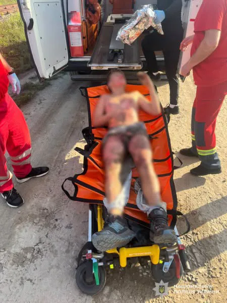 Львів: 13-річний хлопець травмувався через селфі на вагоні 2